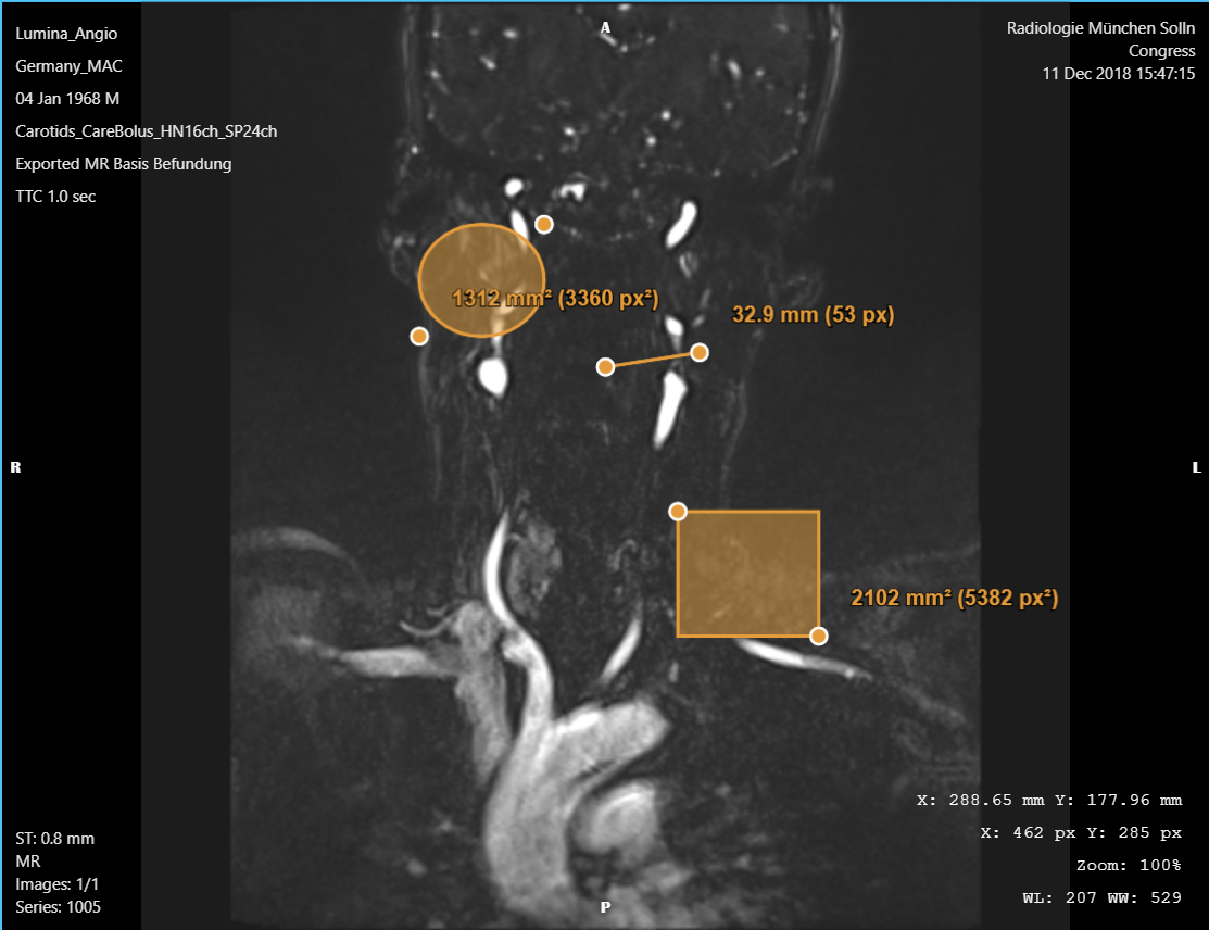 AI Medical Imaging Platform